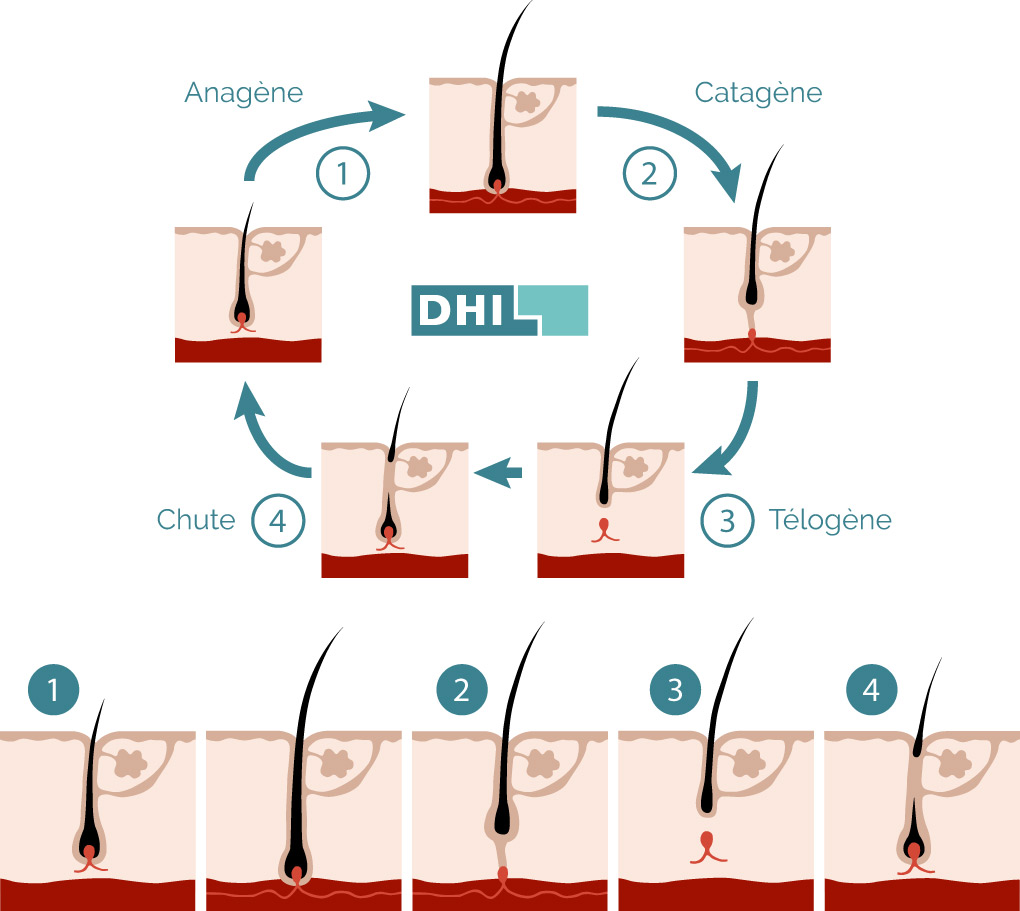 traitement calvitie - Illustration du cycle du cheveu pour comprendre l’alopécie
