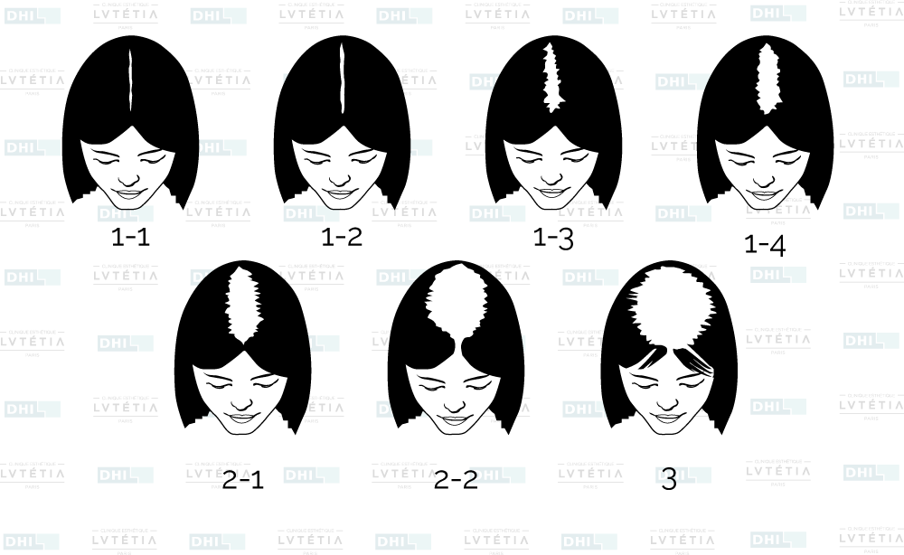 Le masque pour les cheveux doeuf nutritif les rappels