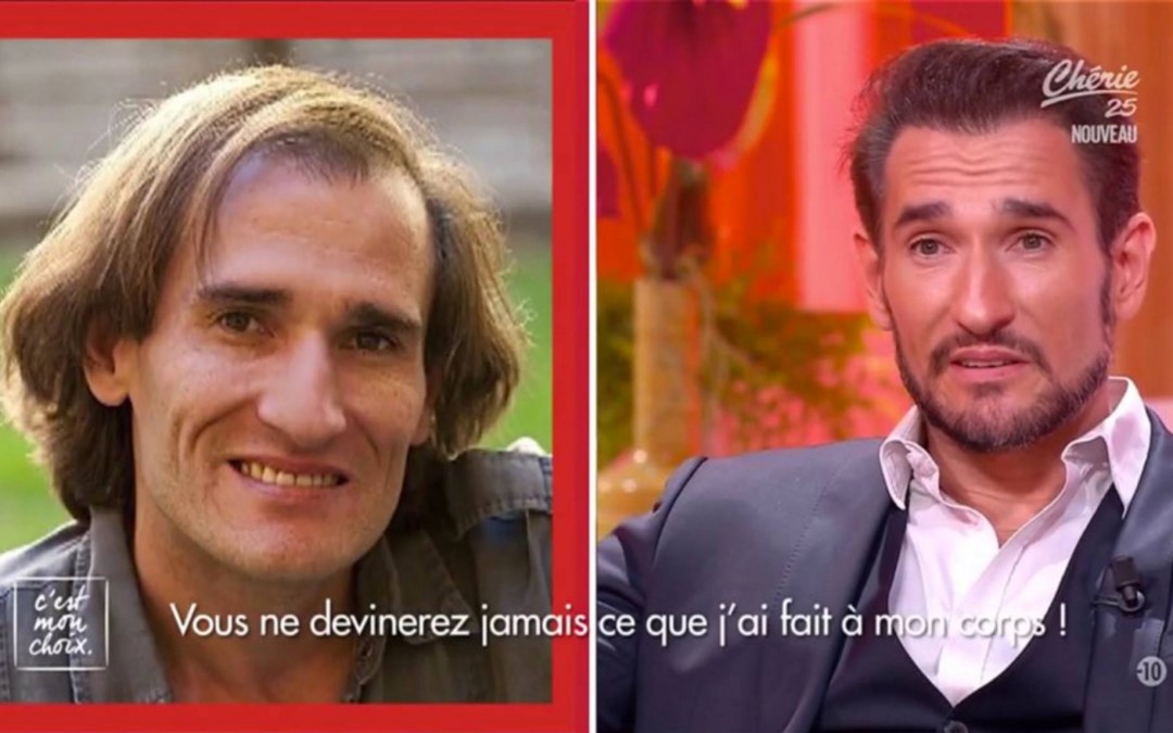 Nos patients témoignent sur le plateau de C’est mon Choix !