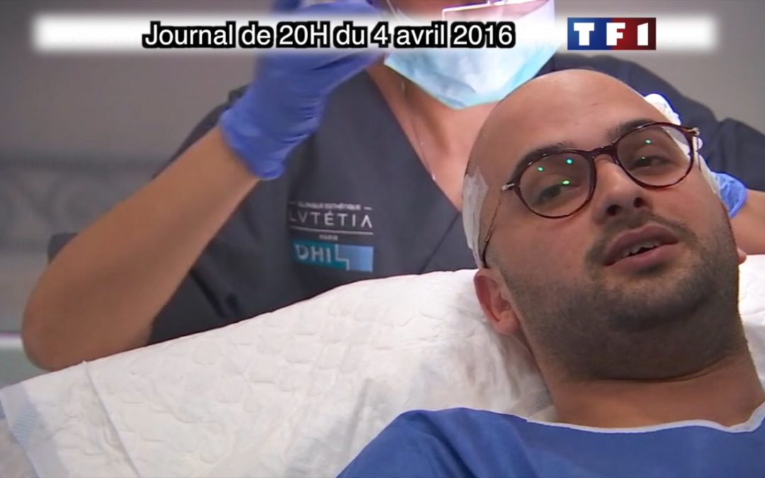 La greffe de cheveux DHI au Journal de 20H sur TF1