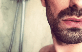 implants de barbe avec la méthode DHI
