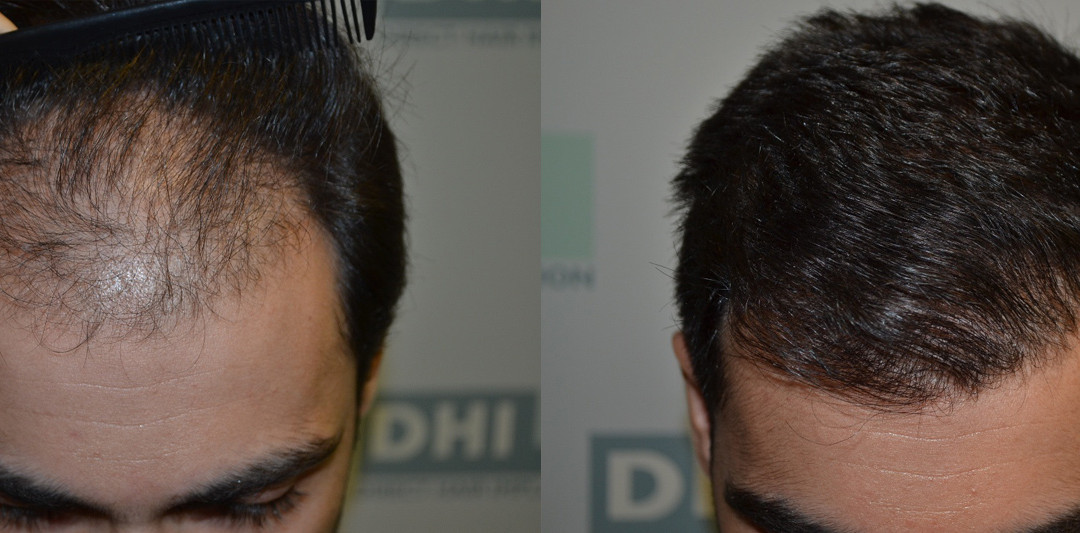 Patient DHI 19
