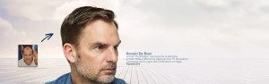 Ronald De Boer greffe capillaire DHI