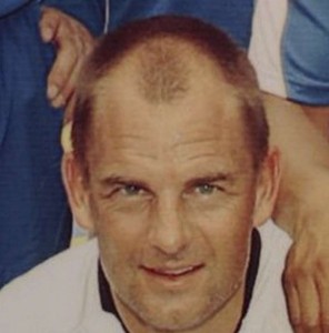 Ronald-De-Boer-Hair-Transplant-Before-2