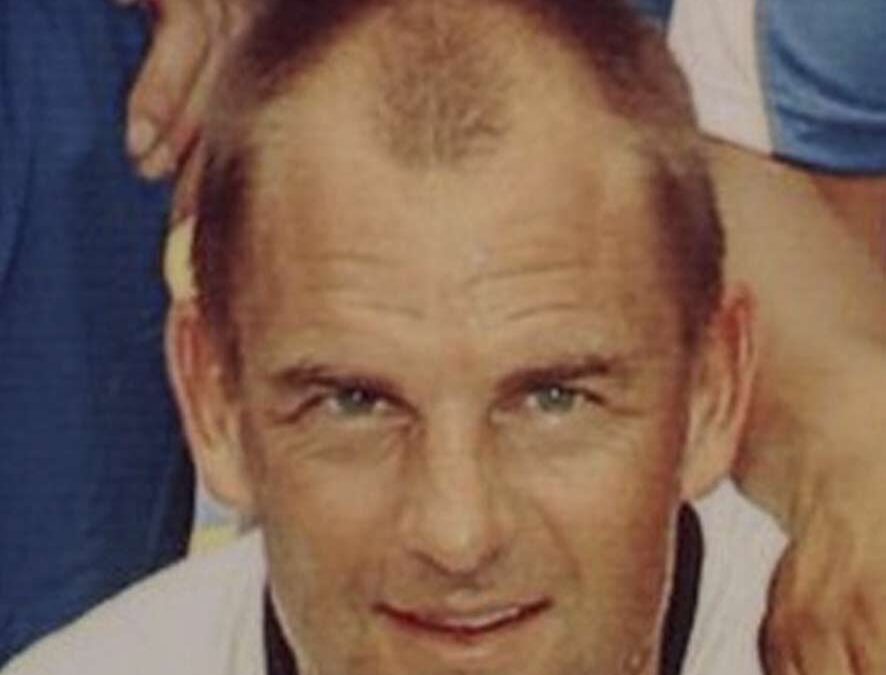 Ronald-De-Boer-Hair-Transplant-Before-2