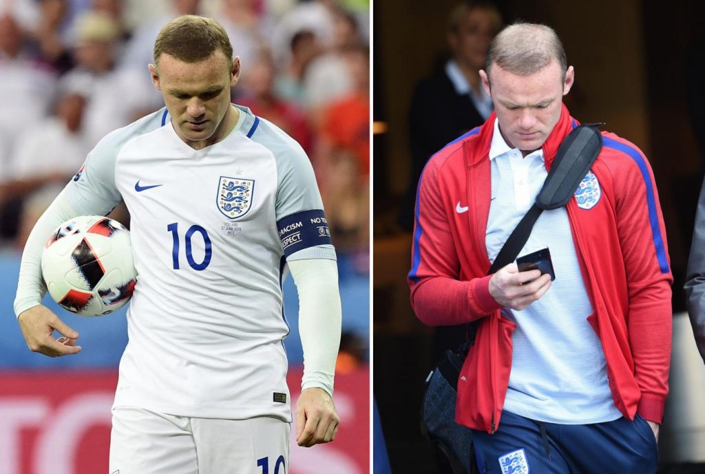 Perte de cheveux wayne rooney