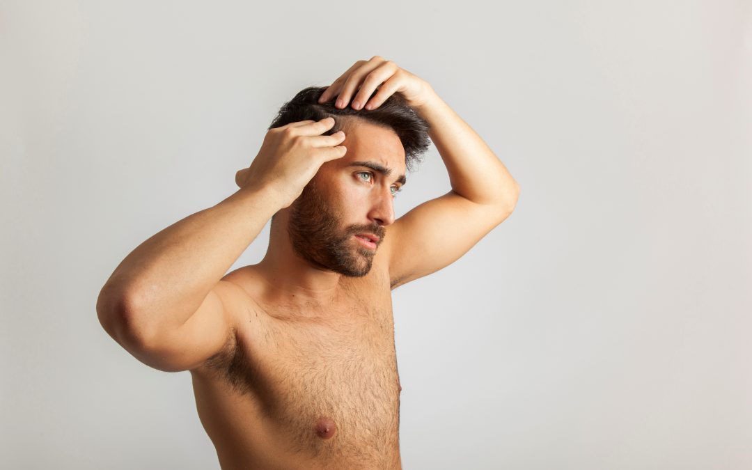 Perte de cheveux : Comment différencier calvitie et pelade ?